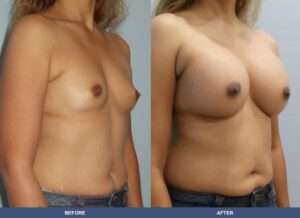 Young Ba A2d Oblique